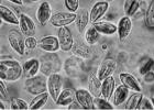 Photomicrograph of myxospores of a Myxobolus sp. from gills of a topminnow, Fundulus. COURTESY PHOTOS